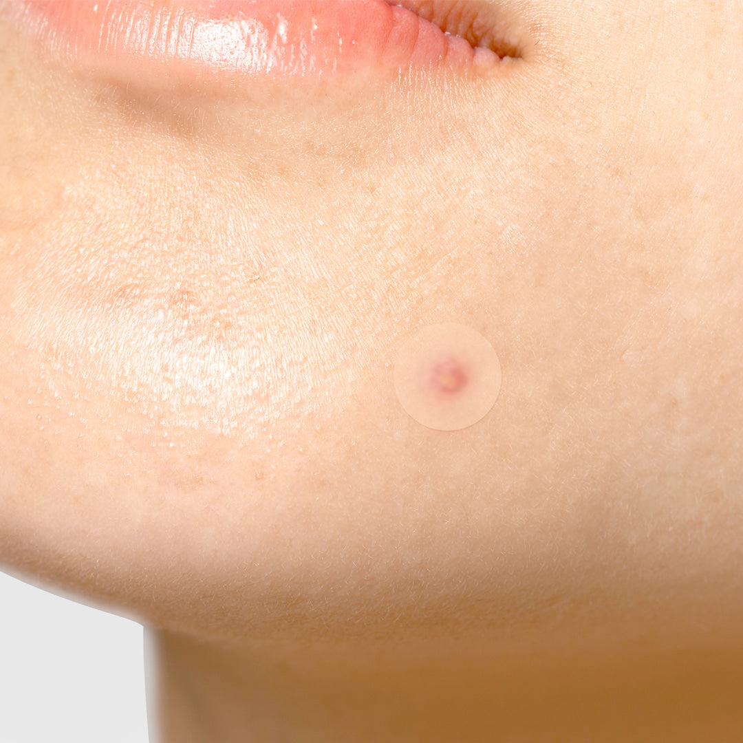 [TIAM] Surprise H Patch 1 pack (18pcs)