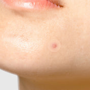 [TIAM] Surprise H Patch 1 pack (18pcs)